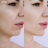 AgeDefy - Innovativer LED Gesichtsstraffer für frisches Strahlen + Gratis Jade Roller
