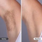 SilkPulse - Effektiver IPL - Haarentferner für glatte Haut + Gratis Make-up-Bag