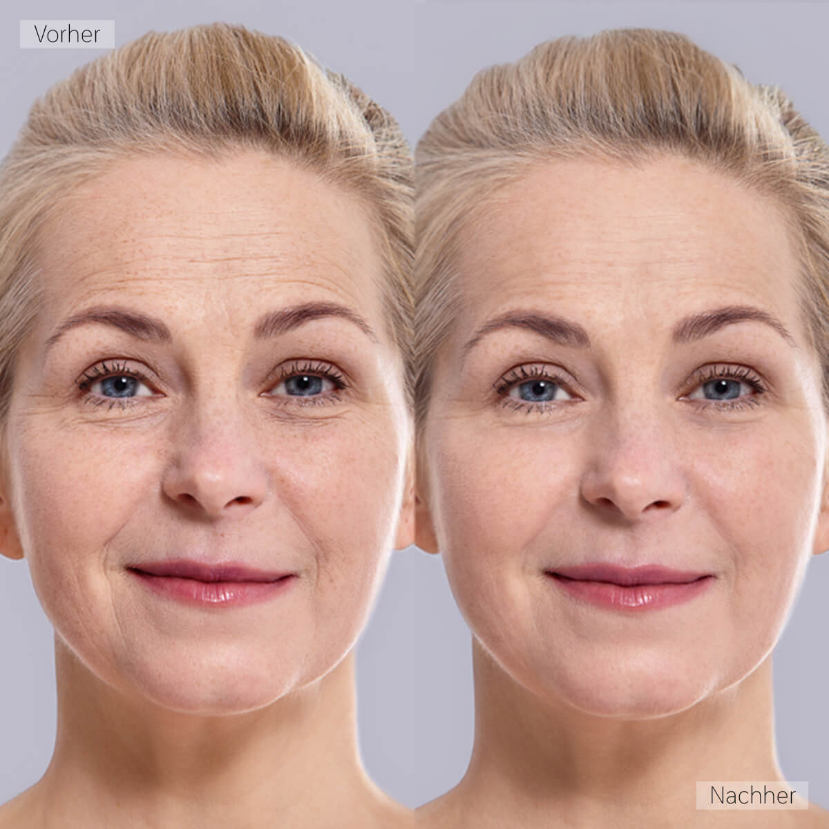 Real Customer Image