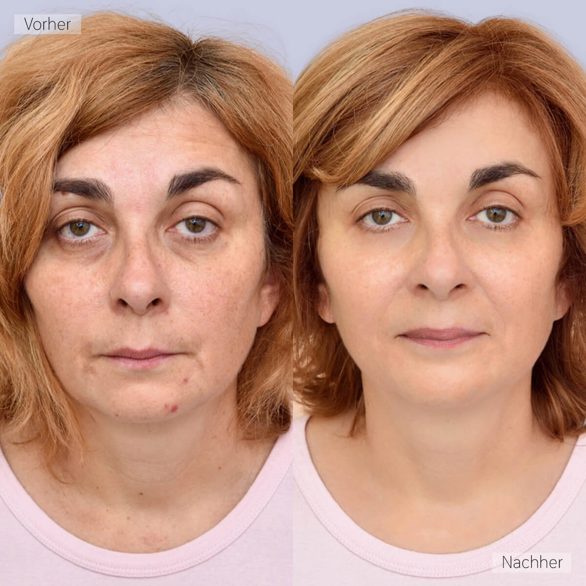 Real Customer Image