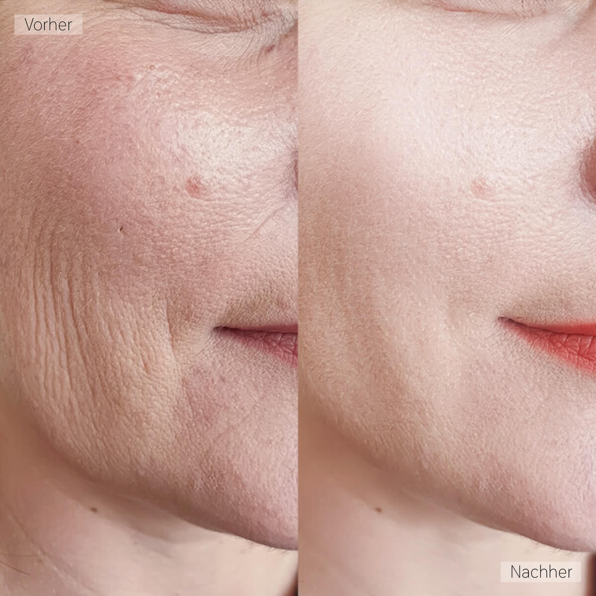 Real Customer Image