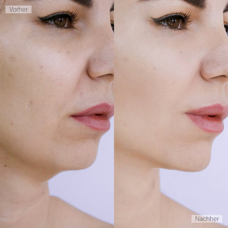 AgeDefy - Innovativer LED Gesichtsstraffer für frisches Strahlen + Gratis Jade Roller