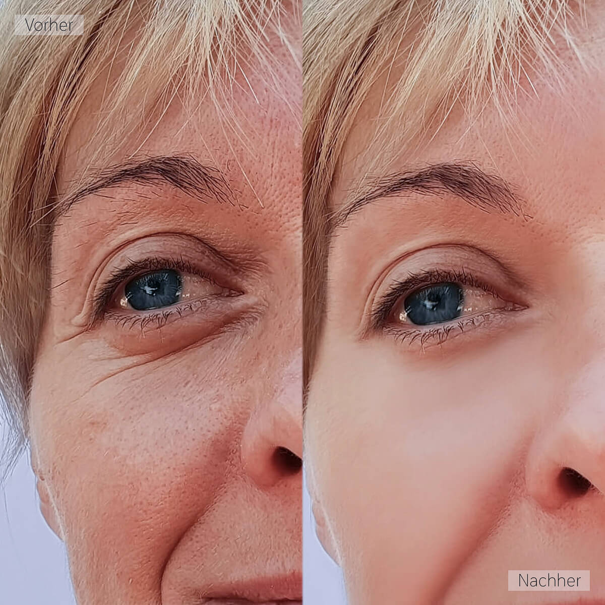 Real Customer Image