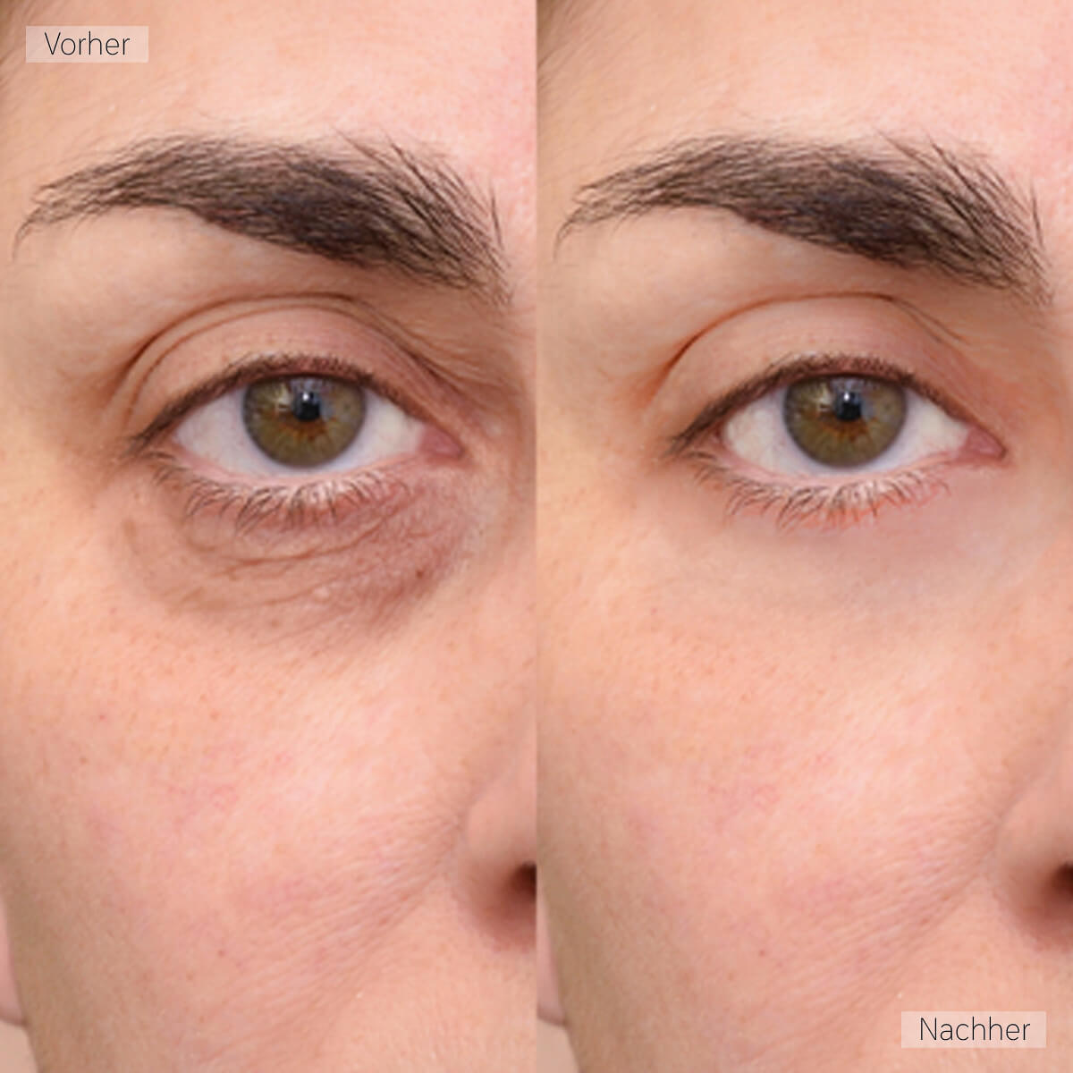 Real Customer Image