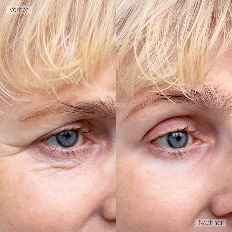 LuxeLift - Exklusives EMS Augenmassagegerät gegen Falten + Gratis Make-up-Bag