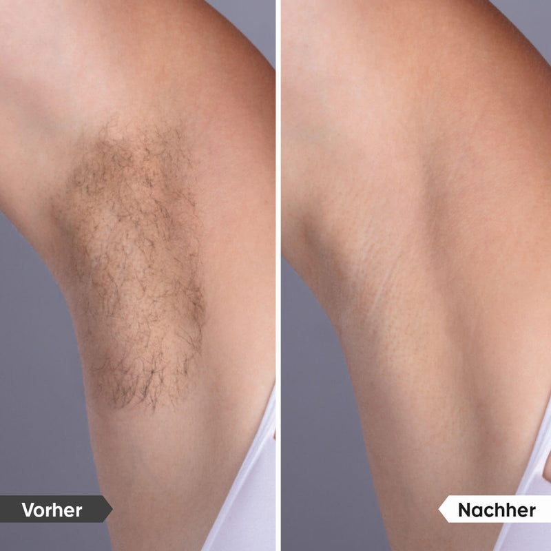 SilkPulse - Effektiver IPL - Haarentferner für glatte Haut + Gratis Make-up-Bag