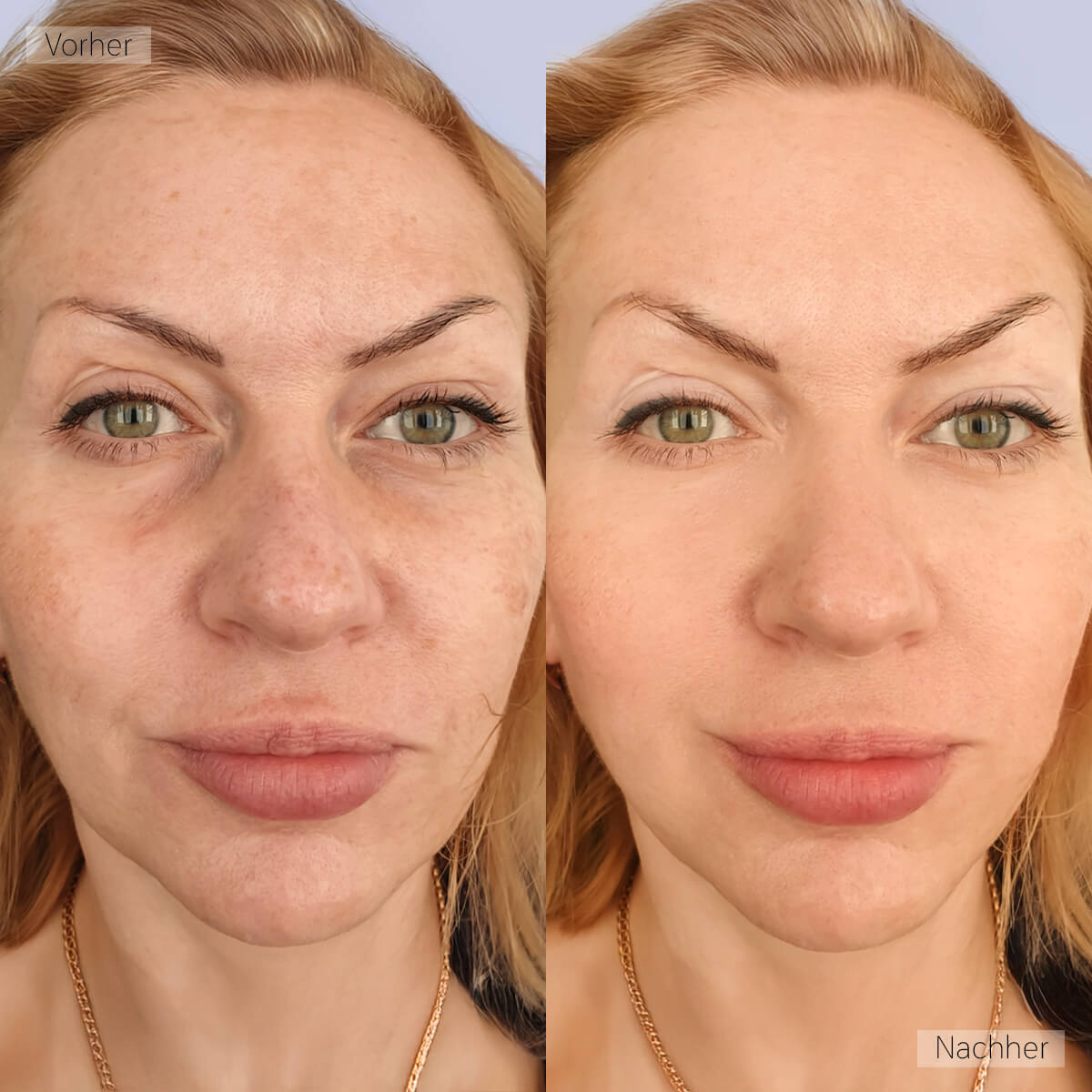 Real Customer Image